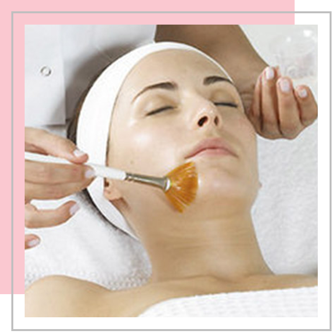 chemische-peeling
