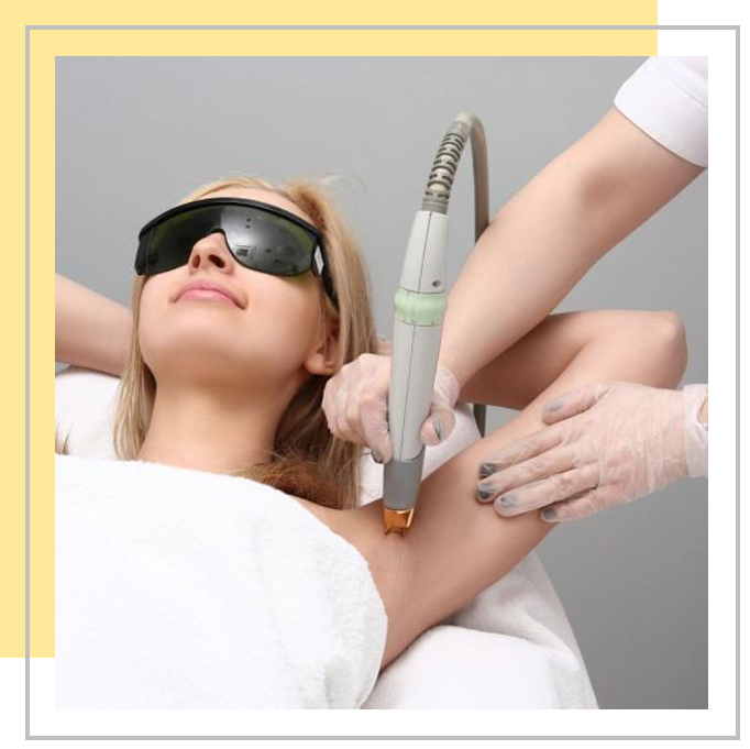 coolglide yag lazer permanent ontharen
