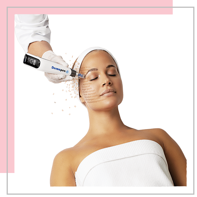 Dermapen gezichtsbehandeling 2